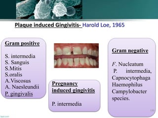 Plaque induced Gingivitis- Harold Loe, 1965
Gram positive
S. intermedia
S. Sanguis
S.Mitis
S.oralis
A.Viscosus
A. Naesleundii
P. gingivalis
Gram negative
F. Nucleatum
P. intermedia,
Capnocytophaga
Haemophilus
Campylobacter
species.
Pregnancy
induced gingivitis
P. intermedia
130
 