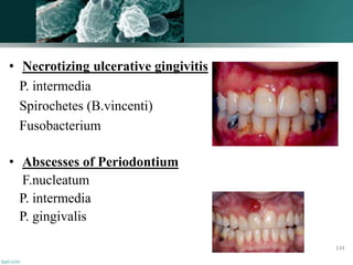 • Necrotizing ulcerative gingivitis
P. intermedia
Spirochetes (B.vincenti)
Fusobacterium
• Abscesses of Periodontium
F.nucleatum
P. intermedia
P. gingivalis
134
 