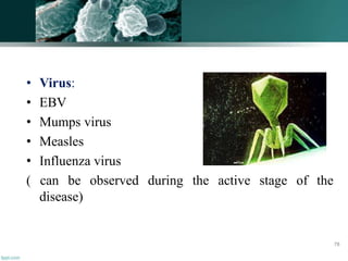• Virus:
• EBV
• Mumps virus
• Measles
• Influenza virus
( can be observed during the active stage of the
disease)
78
 