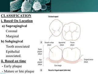 CLASSIFICATION
i. Based On Location
a) Supragingival
Coronal
Marginal
b) Subgingival
Tooth associated
Epithelial
associated.
ii. Based on time
- Early plaque
- Mature or late plaque 83
 