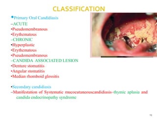 •Primary Oral Candidiasis
–ACUTE
•Pseudomembranous
•Erythematous
–CHRONIC
•Hyperplastic
•Erythematous
•Pseudomembranous
–CANDIDA ASSOCIATED LESION
•Denture stomatitis
•Angular stomatitis
•Median rhomboid glossitis
•Secondary candidiasis
–Manifestation of Systematic mucocutaneouscandidiasis–thymic aplasia and
candida endocrinopathy syndrome
13
 