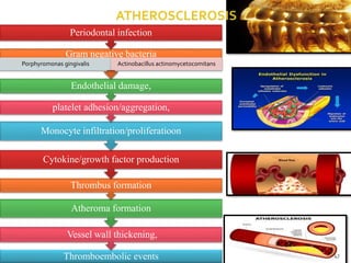 Thromboembolic events
Vessel wall thickening,
Atheroma formation
Thrombus formation
Cytokine/growth factor production
Monocyte infiltration/proliferatioon
platelet adhesion/aggregation,
Endothelial damage,
Gram negative bacteria
Porphyromonas gingivalis Actinobacillus actinomycetocomitans
Periodontal infection
47
 