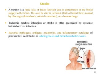  A stroke is a rapid loss of brain function due to disturbance in the blood
supply to the brain. This can be due to ischemia (lack of blood flow) caused
by blockage (thrombosis, arterial embolism), or a haemorrhage
 Ischemic cerebral infarction or stroke is often preceeded by systemic
baterial or viral infection.
 Bacterial pathogens, antigens, endotoxins, and inflammatory cytokines of
periodontitis contributes to atherogenesis and thromboembolic events.
52
 