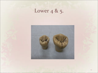 Identification Of Teeth For Oral Exam | PPT
