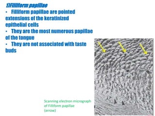 1)Filliform papillae 
• Filliform papillae are pointed 
extensions of the keratinized 
epithelial cells 
• They are the most numerous papillae 
of the tongue 
• They are not associated with taste 
buds 
Scanning electron micrograph 
of Filliform papillae 
(arrow) 
 