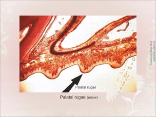 Nasopalatal Ruggae Oral mucosa | PPT