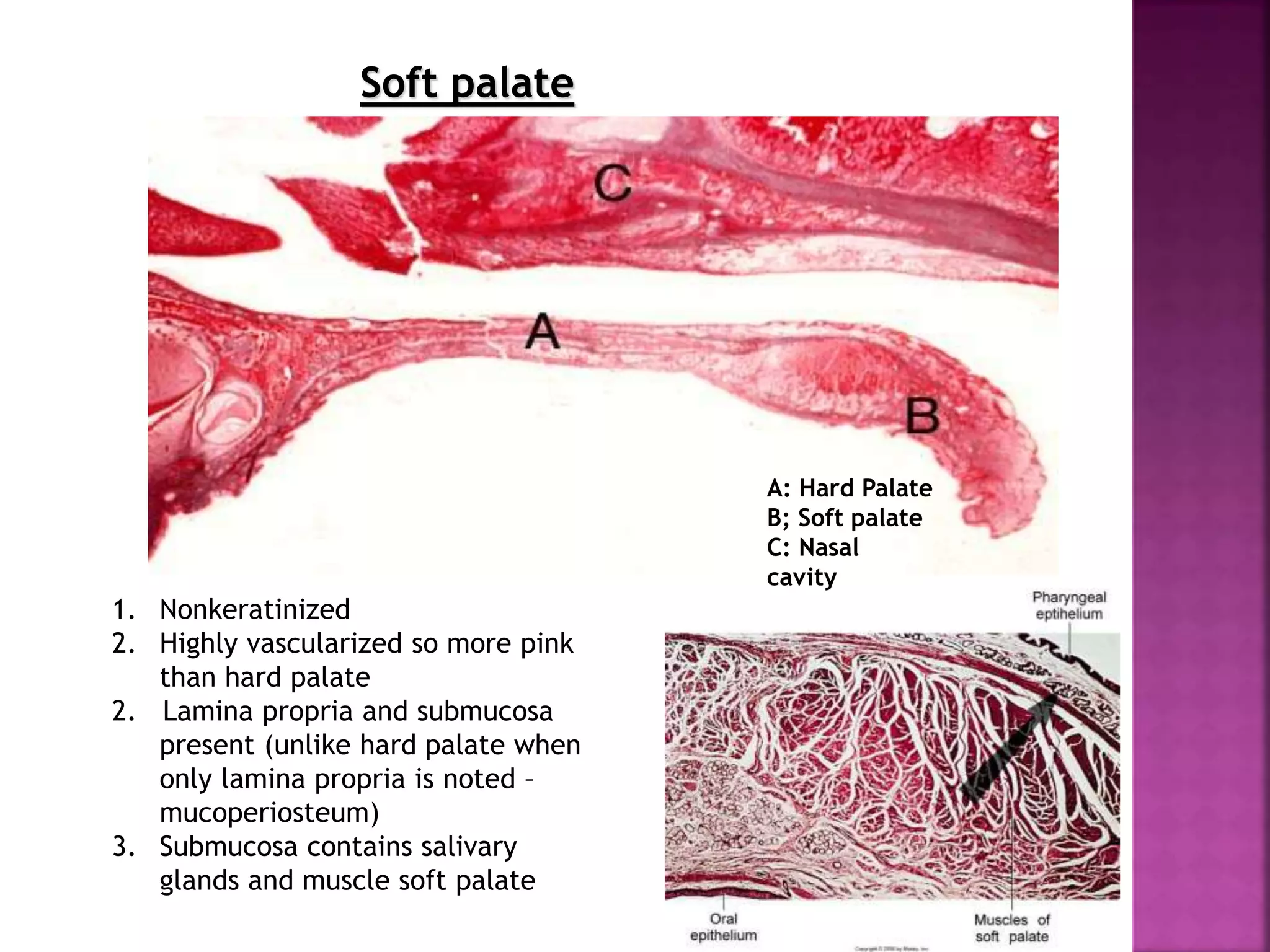 Soft palate
A: Hard Palate
B; Soft palate
C: Nasal
cavity
1. Nonkeratinized
2. Highly vascularized so more pink
than hard palate
2. Lamina propria and submucosa
present (unlike hard palate when
only lamina propria is noted –
mucoperiosteum)
3. Submucosa contains salivary
glands and muscle soft palate
 