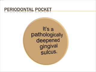 PERIODONTAL POCKET
 