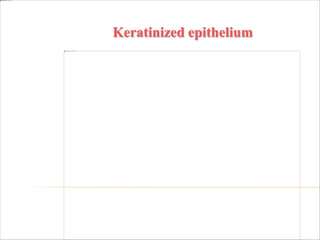 Keratinized epithelium
 