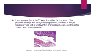 Strecture of oral mucosa in children.pptx