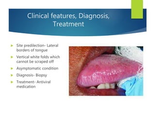 Clinical features, Diagnosis,
Treatment
 Site predilection- Lateral
borders of tongue
 Vertical white folds which
cannot be scraped off
 Asymptomatic condition
 Diagnosis- Biopsy
 Treatment- Antiviral
medication
 
