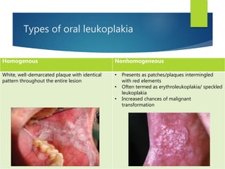 Types of oral leukoplakia
Homogenous Nonhomogeneous
White, well-demarcated plaque with identical
pattern throughout the entire lesion
• Presents as patches/plaques intermingled
with red elements
• Often termed as erythroleukoplakia/ speckled
leukoplakia
• Increased chances of malignant
transformation
 