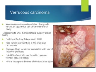 Verrucous carcinoma
 Verrucous carcinoma is a distinct low grade
variant of squamous cell carcinoma of oral
cavity
(According to Oral & maxillofacial surgery clinics-
2006)
 First identified by Ackerman in 1948.
 Rare tumor representing 3-4% of all oral
carcinomas
 Etiology- High incidence associated with use of
tobacco products
 16-51% of oral VCs are found in persons
without tobacco habits
 HPV is thought to be one of the causative agent
 