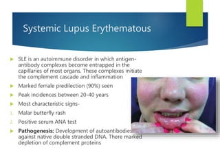 Systemic Lupus Erythematous
 SLE is an autoimmune disorder in which antigen-
antibody complexes become entrapped in the
capillaries of most organs. These complexes initiate
the complement cascade and inflammation
 Marked female predilection (90%) seen
 Peak incidences between 20-40 years
 Most characteristic signs-
1. Malar butterfly rash
2. Positive serum ANA test
 Pathogenesis: Development of autoantibodies
against native double stranded DNA. There marked
depletion of complement proteins
 