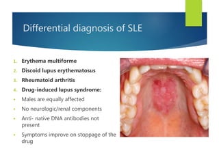Differential diagnosis of SLE
1. Erythema multiforme
2. Discoid lupus erythematosus
3. Rheumatoid arthritis
4. Drug-induced lupus syndrome:
 Males are equally affected
 No neurologic/renal components
 Anti- native DNA antibodies not
present
 Symptoms improve on stoppage of the
drug
 