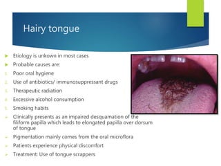 Hairy tongue
 Etiology is unkown in most cases
 Probable causes are:
1. Poor oral hygiene
2. Use of antibiotics/ immunosuppressant drugs
3. Therapeutic radiation
4. Excessive alcohol consumption
5. Smoking habits
 Clinically presents as an impaired desquamation of the
filiform papilla which leads to elongated papilla over dorsum
of tongue
 Pigmentation mainly comes from the oral microflora
 Patients experience physical discomfort
 Treatment: Use of tongue scrappers
 