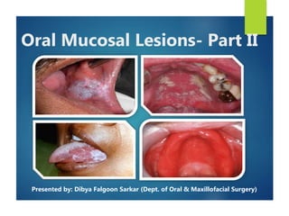 Oral Mucosal Lesions- Part II
Presented by: Dibya Falgoon Sarkar (Dept. of Oral & Maxillofacial Surgery)
 