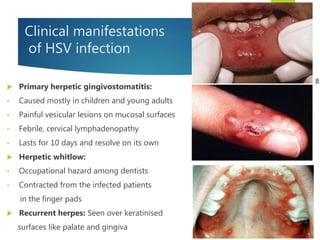 Clinical manifestations
of HSV infection
 Primary herpetic gingivostomatitis:
• Caused mostly in children and young adults
• Painful vesicular lesions on mucosal surfaces
• Febrile, cervical lymphadenopathy
• Lasts for 10 days and resolve on its own
 Herpetic whitlow:
• Occupational hazard among dentists
• Contracted from the infected patients
in the finger pads
 Recurrent herpes: Seen over keratinised
surfaces like palate and gingiva
 