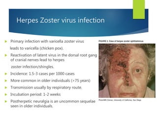 Herpes Zoster virus infection
 Primary infection with varicella zoster virus
leads to varicella (chicken pox).
 Reactivation of latent virus in the dorsal root ganglia
of cranial nerves lead to herpes
zoster infection/shingles.
 Incidence: 1.5-3 cases per 1000 cases
 More common in older individuals (>75 years)
 Transmission usually by respiratory route.
 Incubation period: 1-2 weeks
 Postherpetic neuralgia is an uncommon sequelae
seen in older individuals.
 