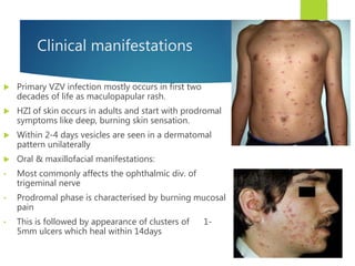 Clinical manifestations
 Primary VZV infection mostly occurs in first two
decades of life as maculopapular rash.
 HZI of skin occurs in adults and start with prodromal
symptoms like deep, burning skin sensation.
 Within 2-4 days vesicles are seen in a dermatomal
pattern unilaterally
 Oral & maxillofacial manifestations:
• Most commonly affects the ophthalmic div. of
trigeminal nerve
• Prodromal phase is characterised by burning mucosal
pain
• This is followed by appearance of clusters of 1-
5mm ulcers which heal within 14days
 