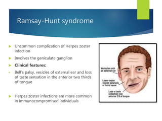 Ramsay-Hunt syndrome
 Uncommon complication of Herpes zoster
infection
 Involves the geniculate ganglion
 Clinical features:
 Bell’s palsy, vesicles of external ear and loss
of taste sensation in the anterior two thirds
of tongue
 Herpes zoster infections are more common
in immunocompromised individuals
 