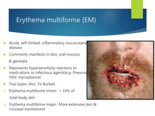 Erythema multiforme (EM)
 Acute, self-limited, inflammatory mucocutaneous
disease.
 Commonly manifests in skin, oral mucosa
& genitalia
 Represents hypersensitivity reactions to
medications or infectious agents(e.g: Pneumonia,
HSV, mycoplasma)
 Two types: (Acc. To Burket)
1) Erythema multiforme minor- < 10% of
total body skin
1) Erythema multiforme major- More extensive skin &
mucosal involvement
 