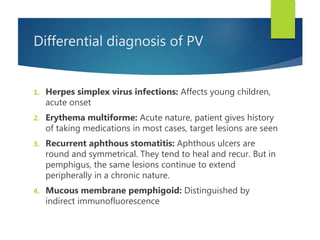 Differential diagnosis of PV
1. Herpes simplex virus infections: Affects young children,
acute onset
2. Erythema multiforme: Acute nature, patient gives history
of taking medications in most cases, target lesions are seen
3. Recurrent aphthous stomatitis: Aphthous ulcers are
round and symmetrical. They tend to heal and recur. But in
pemphigus, the same lesions continue to extend
peripherally in a chronic nature.
4. Mucous membrane pemphigoid: Distinguished by
indirect immunofluorescence
 