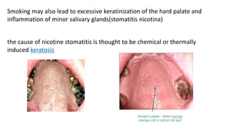 Smoking may also lead to excessive keratinization of the hard palate and
inflammation of minor salivary glands(stomatitis nicotina)
the cause of nicotine stomatitis is thought to be chemical or thermally
induced keratosis
 