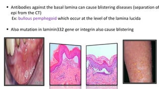  Antibodies against the basal lamina can cause blistering diseases (separation of
epi from the CT)
Ex: bullous pemphegoid which occur at the level of the lamina lucida
 Also mutation in laminin332 gene or integrin also cause blistering
 