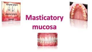 Masticatory
mucosa
 