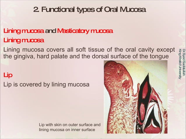 Oral Mucous Membrane | PPT