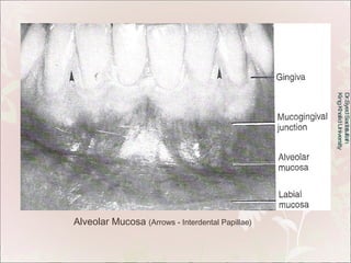 Dr.Syed Sadatullah  King Khalid University  Alveolar Mucosa  (Arrows - Interdental Papillae) 