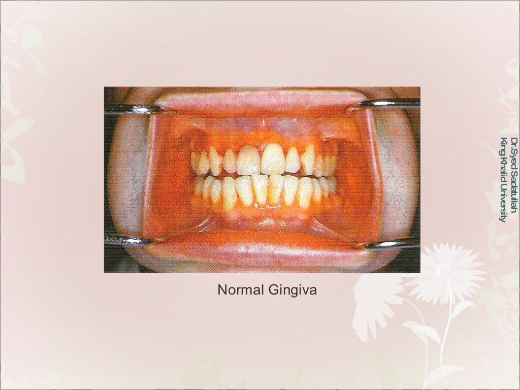 Oral Mucous Membrane
