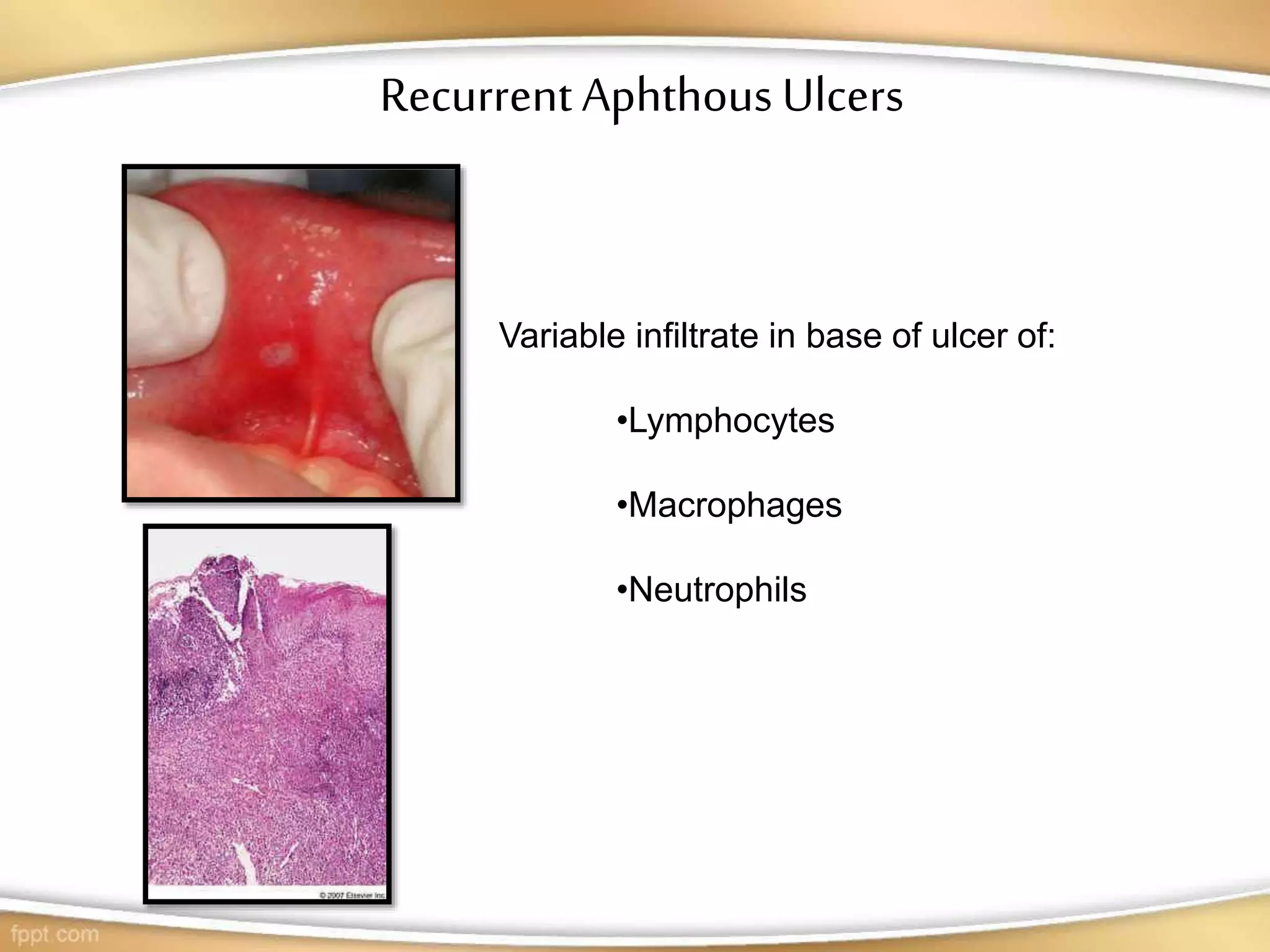 Oral mucous membrane | PPT