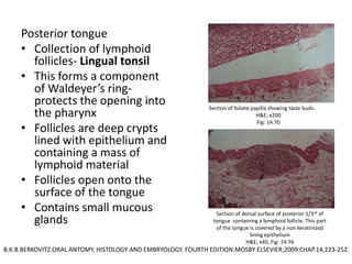 Posterior tongue
• Collection of lymphoid
follicles- Lingual tonsil
• This forms a component
of Waldeyer’s ring-
protects the opening into
the pharynx
• Follicles are deep crypts
lined with epithelium and
containing a mass of
lymphoid material
• Follicles open onto the
surface of the tongue
• Contains small mucous
glands
Section of dorsal surface of posterior 1/3rd of
tongue containing a lymphoid follicle. This part
of the tongue is covered by a non keratinized
lining epithelium
H&E; x40, Fig: 14.76
Section of foliate papilla showing taste buds.
H&E; x200
Fig: 14.70
B.K.B.BERKOVITZ.ORAL ANTOMY, HISTOLOGY AND EMBRYOLOGY. FOURTH EDITION:MOSBY ELSEVIER;2009.CHAP.14;223-252.
 