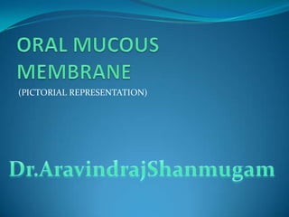 Oral mucous membrane pictorial representation | PPTX