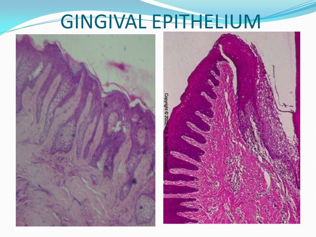 Oral mucous membrane pictorial representation