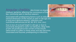 oral mucous membrane manjusha mam ppt.pptx