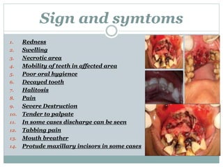 Sign and symtoms
1. Redness
2. Swelling
3. Necrotic area
4. Mobility of teeth in affected area
5. Poor oral hygience
6. Decayed tooth
7. Halitosis
8. Pain
9. Severe Destruction
10. Tender to palpate
11. In some cases discharge can be seen
12. Tabbing pain
13. Mouth breather
14. Protude maxillary incisors in some cases
 