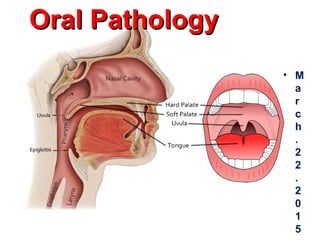 Oral PathologyOral Pathology
• M
a
r
c
h
.
2
2
.
2
0
1
5
 