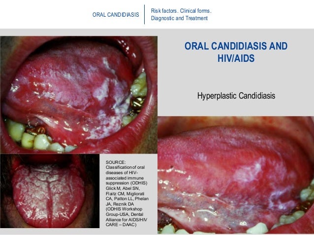 oral pathology oral pathology