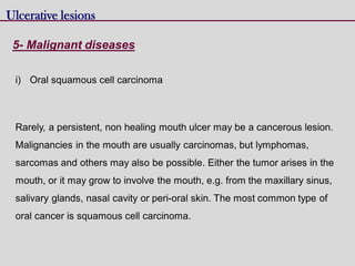 5- Malignant diseases
Ulcerative lesions
i) Oral squamous cell carcinoma
Rarely, a persistent, non healing mouth ulcer may be a cancerous lesion.
Malignancies in the mouth are usually carcinomas, but lymphomas,
sarcomas and others may also be possible. Either the tumor arises in the
mouth, or it may grow to involve the mouth, e.g. from the maxillary sinus,
salivary glands, nasal cavity or peri-oral skin. The most common type of
oral cancer is squamous cell carcinoma.
 