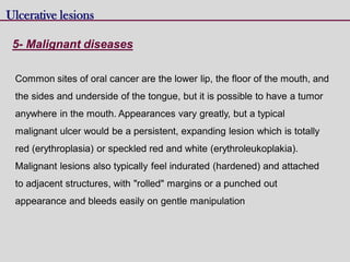 5- Malignant diseases
Ulcerative lesions
Common sites of oral cancer are the lower lip, the floor of the mouth, and
the sides and underside of the tongue, but it is possible to have a tumor
anywhere in the mouth. Appearances vary greatly, but a typical
malignant ulcer would be a persistent, expanding lesion which is totally
red (erythroplasia) or speckled red and white (erythroleukoplakia).
Malignant lesions also typically feel indurated (hardened) and attached
to adjacent structures, with "rolled" margins or a punched out
appearance and bleeds easily on gentle manipulation
 