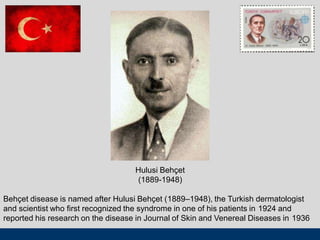 Hulusi Behçet
(1889-1948)
Behçet disease is named after Hulusi Behçet (1889–1948), the Turkish dermatologist
and scientist who first recognized the syndrome in one of his patients in 1924 and
reported his research on the disease in Journal of Skin and Venereal Diseases in 1936
 