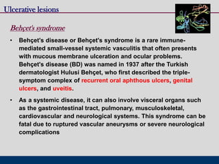 Behçet's syndrome
• Behçet's disease or Behçet's syndrome is a rare immune-
mediated small-vessel systemic vasculitis that often presents
with mucous membrane ulceration and ocular problems.
Behçet's disease (BD) was named in 1937 after the Turkish
dermatologist Hulusi Behçet, who first described the triple-
symptom complex of recurrent oral aphthous ulcers, genital
ulcers, and uveitis.
• As a systemic disease, it can also involve visceral organs such
as the gastrointestinal tract, pulmonary, musculoskeletal,
cardiovascular and neurological systems. This syndrome can be
fatal due to ruptured vascular aneurysms or severe neurological
complications
Ulcerative lesions
 