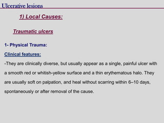 1- Physical Trauma:
Clinical features:
-They are clinically diverse, but usually appear as a single, painful ulcer with
a smooth red or whitish-yellow surface and a thin erythematous halo. They
are usually soft on palpation, and heal without scarring within 6–10 days,
spontaneously or after removal of the cause.
Ulcerative lesions
Traumatic ulcers
1) Local Causes:
 
