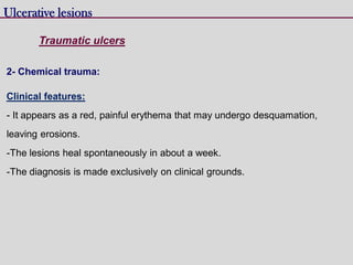 Ulcerative lesions
Traumatic ulcers
2- Chemical trauma:
Clinical features:
- It appears as a red, painful erythema that may undergo desquamation,
leaving erosions.
-The lesions heal spontaneously in about a week.
-The diagnosis is made exclusively on clinical grounds.
 