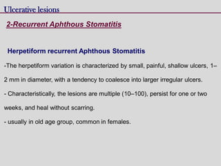 Herpetiform recurrent Aphthous Stomatitis
-The herpetiform variation is characterized by small, painful, shallow ulcers, 1–
2 mm in diameter, with a tendency to coalesce into larger irregular ulcers.
- Characteristically, the lesions are multiple (10–100), persist for one or two
weeks, and heal without scarring.
- usually in old age group, common in females.
Ulcerative lesions
2-Recurrent Aphthous Stomatitis
 