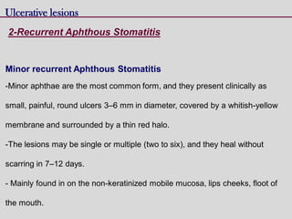Minor recurrent Aphthous Stomatitis
-Minor aphthae are the most common form, and they present clinically as
small, painful, round ulcers 3–6 mm in diameter, covered by a whitish-yellow
membrane and surrounded by a thin red halo.
-The lesions may be single or multiple (two to six), and they heal without
scarring in 7–12 days.
- Mainly found in on the non-keratinized mobile mucosa, lips cheeks, floot of
the mouth.
Ulcerative lesions
2-Recurrent Aphthous Stomatitis
 