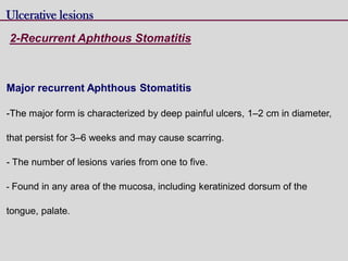 Major recurrent Aphthous Stomatitis
-The major form is characterized by deep painful ulcers, 1–2 cm in diameter,
that persist for 3–6 weeks and may cause scarring.
- The number of lesions varies from one to five.
- Found in any area of the mucosa, including keratinized dorsum of the
tongue, palate.
Ulcerative lesions
2-Recurrent Aphthous Stomatitis
 